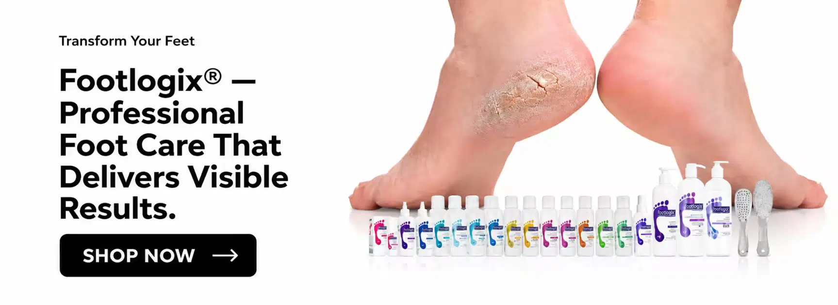 Footlogix