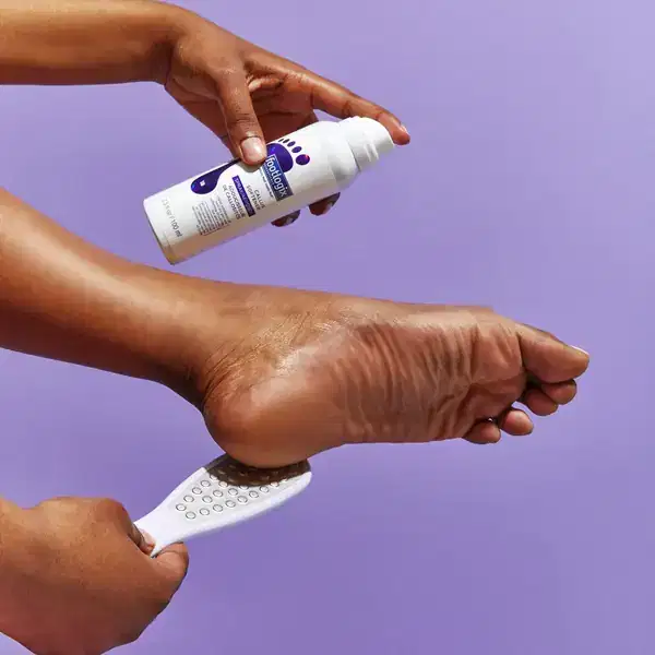 FOOTLOGIX Bye Bye Callus Kit - EXPSPI. Number 7+, Callus Softener Home Care and Foot File